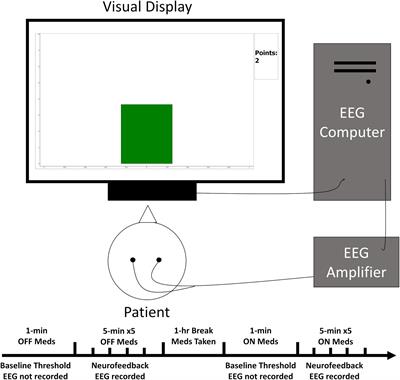 A Single Case Feasibility Study of Sensorimotor Rhythm Neurofeedback in Parkinson’s Disease